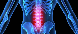 The deformation of the disc