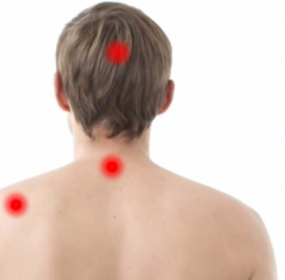 outbreaks of the disease, degenerative disk
