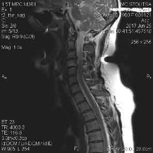 The low back pain and cervical spondylosis of the vertebral column