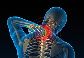 Because it develops and how cervical osteochondrosis is manifested